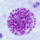 Toxoplasma gondii tissue cyst in a mouse brain. A correlation between the parasite and Intermittent Explosive Disorder (IED) in humans has been observed. IED causes people to react with inappropriate aggression.